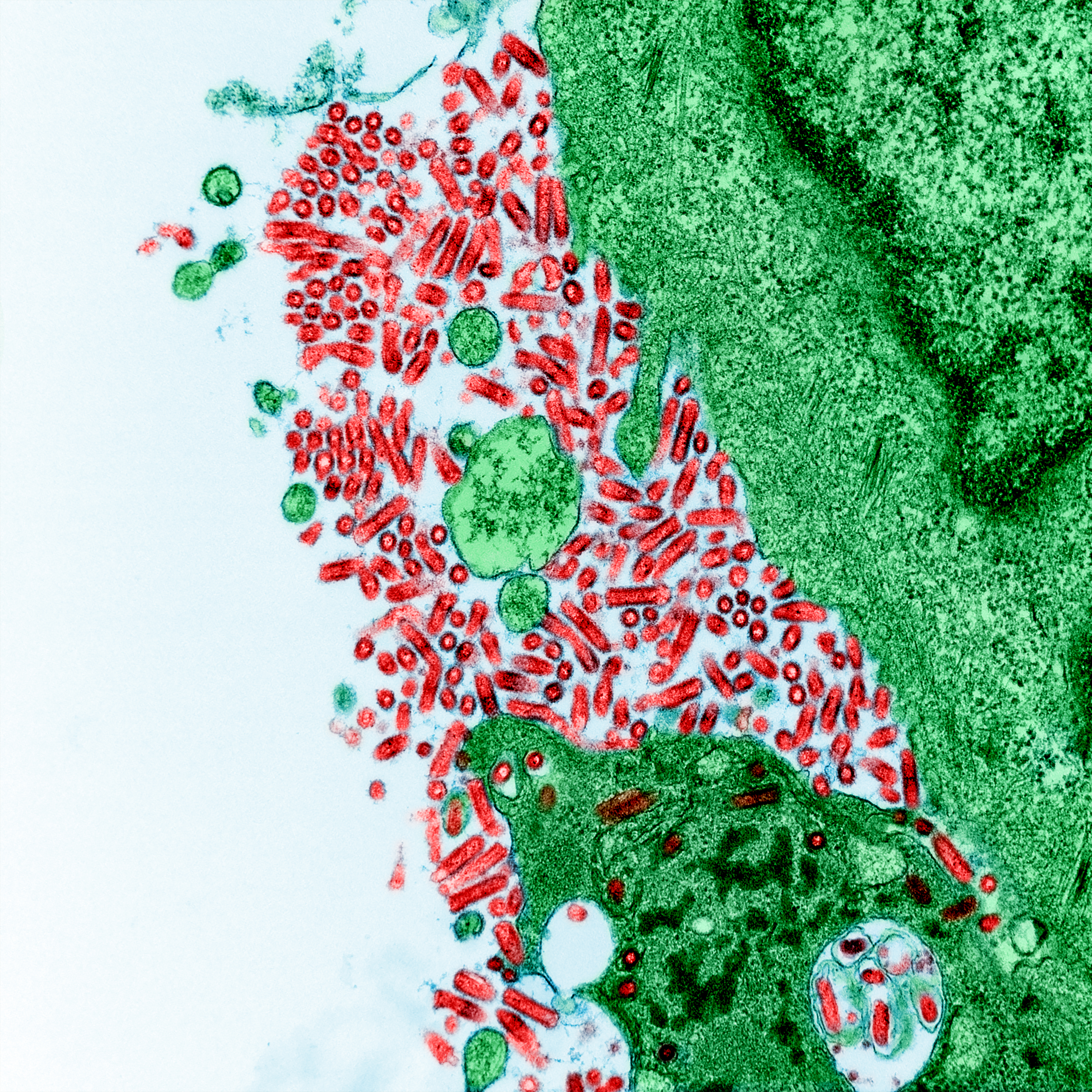 Electron micrograph of rabies virus